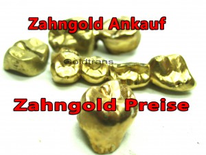 Zahngold ankauf hamburg